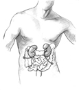Drawing of a ureterostomy with two stomas.