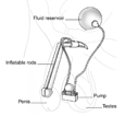 Diagram of a penile implant.
