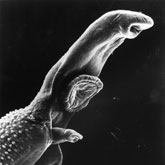 The schistosome parasite