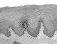 Drawing of normal tissue in the esophagus.