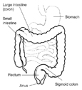 Drawing of the lower digestive tract with stomach, large intestine (colon), small intestine, sigmoid colon, rectum, and anus labeled.