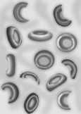 Drawing of broken red blood cells, as seen in the blood of people with hemolytic uremic syndrome.