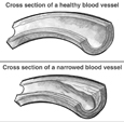 Drawing of two cross sections of blood vessels. One is labeled 
