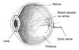 Drawing of an eye cross section showing the lens, retina, blood vessels, optic nerve, and vitreous labeled.
