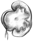 Drawing of a swollen kidney that results from ureteropelvic junction obstruction.