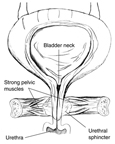 Diagram of front view of female bladder with strong pelvic muscles keeping the urethra closed. The bladder is shown in cross-section to reveal urine in the bladder. Labels point to the bladder neck, strong pelvic muscles, urethral sphincter, and urethra.