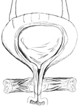 Diagram of front view of female bladder with strong pelvic muscles keeping the urethra closed. The bladder is shown in cross-section to reveal urine in the bladder.