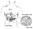 Drawing of a body torso showing the location of the liver and the pancreas with an enlargement of a pancreatic islet containing beta cells.