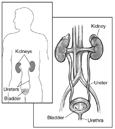 Drawing of a normal urinary tract with kidneys, ureters, bladder, and urethra labeled. The bladder is shown in cross section to reveal interior wall and openings where the ureters empty into the bladder. An inset shows a smaller representation of the urinary tract placed within the outline of an adult male figure.
