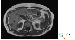 MRI without contrast