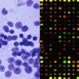Pathology Slide and DNA Microarray Data Slide