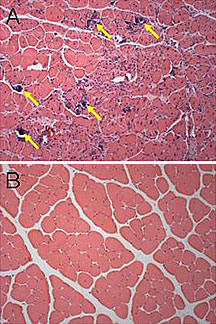 New polymers like MIT's C32 may deliver drugs better than existing polymers used for gene therapy. In image A, a muscle injected with an older polymer and DNA shows calcification damage to cells (indicated by the arrows). In image B, a muscle injected with MIT's new C32 polymer and DNA does not show similar damage.