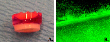 Image of hydrogel and tissue growth.