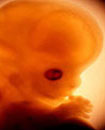 Image  of human embryo