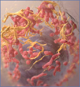 3D image of human melanoma cell