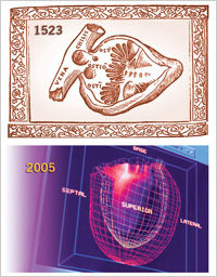 Picture of woodcut from 1523 and MRI from 2005
