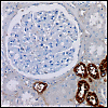 Modified from Fig 1 Fritzsche et al.