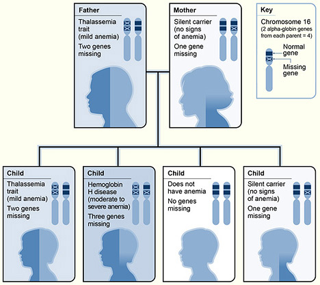 A diagram showing one example of how alpha thalassemia is inherited. The alpha globin genes are located on chromosome 16. A child inherits four alpha globin genes-two from each parent.