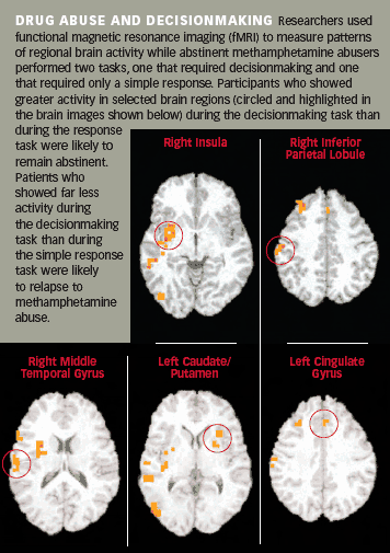 Brains Scans Grpahic