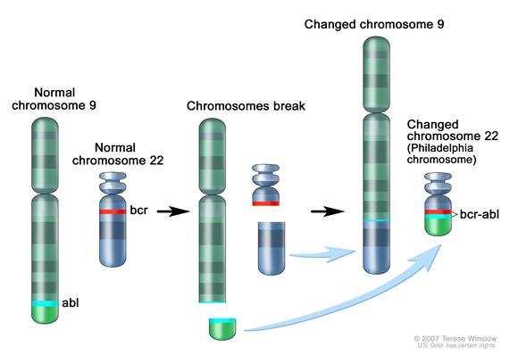 Philadelphia chromosome; three-panel drawing shows a piece of chromosome 9 and a piece of chromosome 22 breaking off and trading places, creating a changed chromosome 22 called the Philadelphia chromosome. In the left panel, the drawing shows a normal chromosome 9 with the abl gene and a normal chromosome 22 with the bcr gene. In the center panel, the drawing shows chromosome 9 breaking apart in the abl gene and chromosome 22 breaking apart below the bcr gene. In the right panel, the drawing shows chromosome 9 with the piece from chromosome 22 attached and chromosome 22 with the piece from chromosome 9 containing part of the abl gene attached. The changed chromosome 22 with bcr-abl gene is called the Philadelphia chromosome.