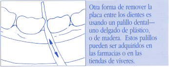 Otra forma de remover la placa entre los dientes es usando un palillo dental -- uno delgado de plastico, o de madera. Estos palillos pueden ser adquiridos en las famacias o en las tiendas de vivers.