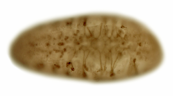 Fly embryo showing nervous system phenotypic mutation