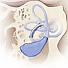 Diagram of inner ear showing enlarged vestibular aqueduct