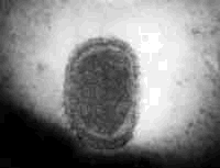 Transmission electron micrograph of poxvirus of molluscum contagiosum