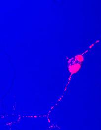 Prion trafficking in hamster nerve cells
