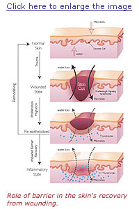 Role of barrier in the skin's recovery from wounding.
