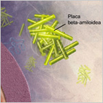 los fragmentos beta-amiloideos empiezan a unirse en masas