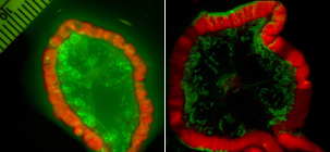 An activatable probe (right) shows a metastatic ovarian tumor with minimal background signals. The control 'always on' probe (left) lacks clear delineation of cancer foci due to high background signals. (Image courtesy of Dr. Hisataka Kobayashi).