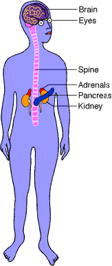 Location of parts of body affected by VHL.