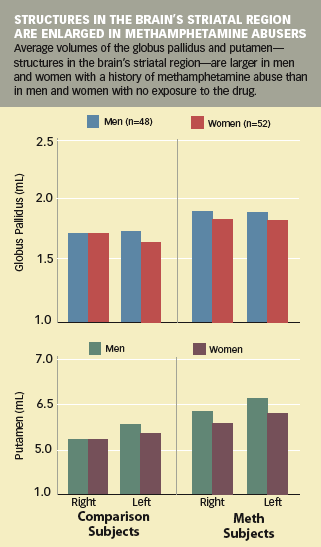 STRUCTURES IN THE BRAIN'S STRIATAL REGION ARE ENLARGED IN METHAMPHETAMINE ABUSERS -  Graphic