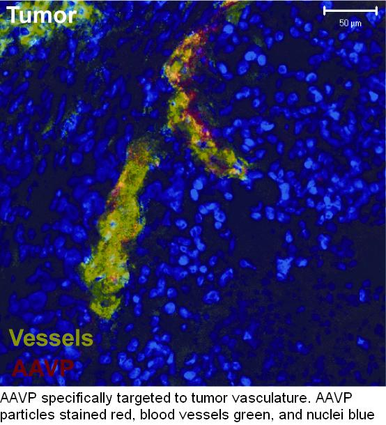  AAVP specifically targeted to tumor vasculature. AAVP particles stained red, blood vessels green, and nuclei blue 