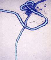 Ebola virus (Credit: CDC)