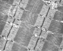 Microscopic field showing several sarcomeres, each with a heavy black line at either end. Sets of lighter parallel filaments extend about a quarter of the way toward the centers. The filaments filling the middle half are darker.