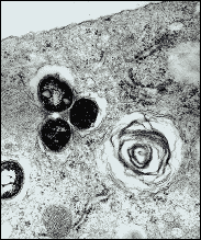 Three TB bacteria (dark circular objects) shown inside an animal cell.