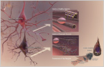 The inside of a healthy neuron and a diseased neuron, and the process of formation of tau tangles