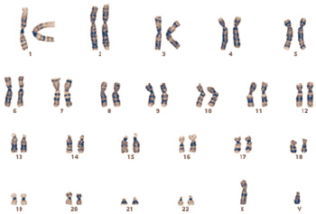 Humans have 23 pairs of chromosomes. Male DNA, pictured here, contains an X and a Y chromosome, whereas female DNA contains two X chromosomes.