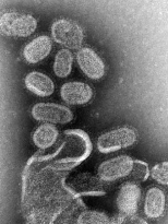 1918 influenza virus