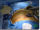 Fotografias de procedimiento quirúrgico