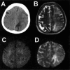 figure 6FF2