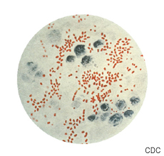 Micrografía de Yersinia (Pasteurella) pestis, la bacteria que causa el peste en animales y humanos
