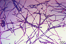Photomicrograph of Bacillus anthracis bacteria using Gram stain technique