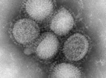H1N1 Virus Image Courtesy of CDC