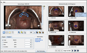 A screenshot the CervigramFinder application.