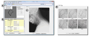 A screenshot ot the Spine Pathology and Image Retrieval System (SPIRS).