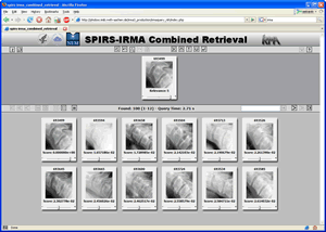 A screenshot of SPIRS-IRMA.