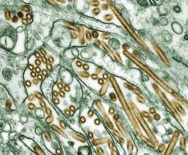 Picture of Avian influenza viruses (gold) grown in culture cells (green).
